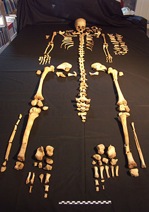 Skeleton 8, a teenage male
