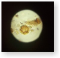 A view through a microscope lens at some pollen